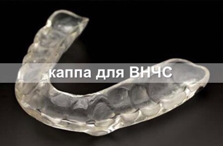 Transparent splint with the original caption about a TMJ splint.