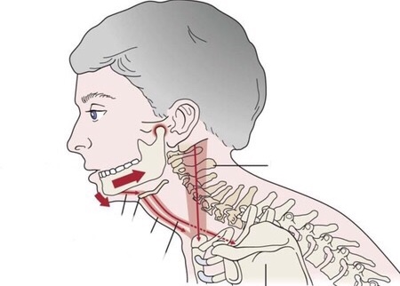 Lateral head, neck and chest diagram with red arrows.