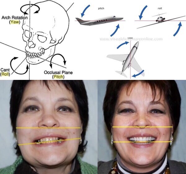 Collage: skull diagram, aircraft with arrows and two face photographs with yellow lines.