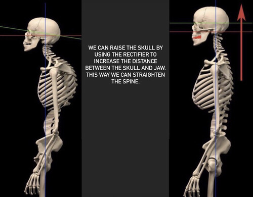 Two lateral skeletons, guide lines and original text about Rectifier.