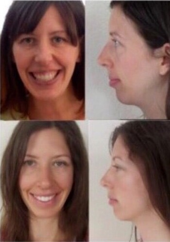 Four photographs of a woman: frontal portraits and profile views in two rows.