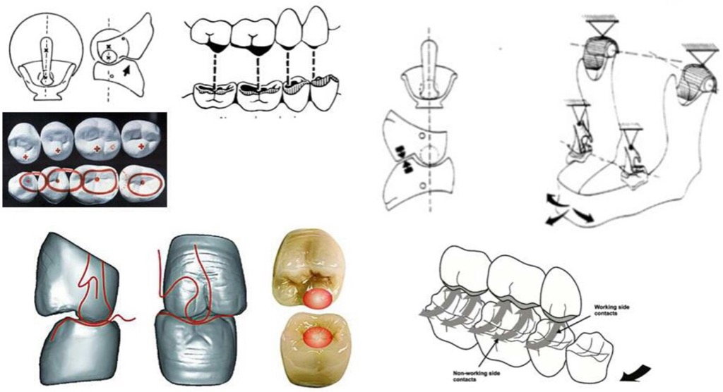 Collage: tooth and jaw diagrams, movement arrows and tooth contact labels.