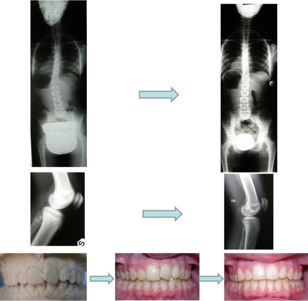 Radiographs, a dental cast and dental photographs with arrows.