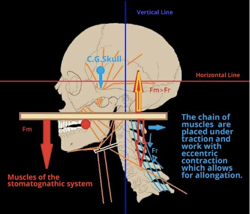 Side-view skull and neck diagram with coloured lines, arrows and muscle captions.