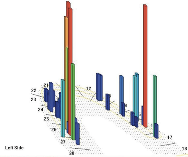 Coloured three-dimensional bar chart with numbers and a grid.