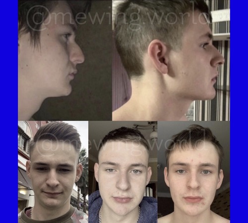 Five male portraits on a blue background.