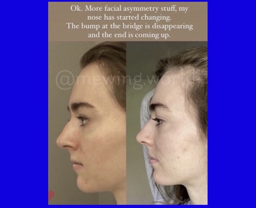 Two female profiles with an English caption.