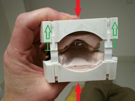 Dental models in a white holder with red and green arrows.