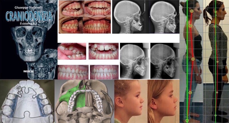 Craniodontie : les meilleurs spécialistes