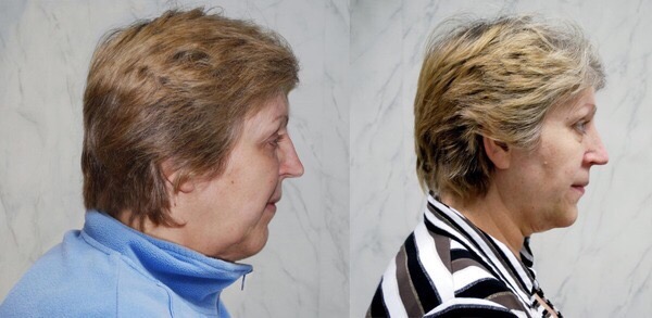 Two profile photographs of a woman with different clothes and lighting.