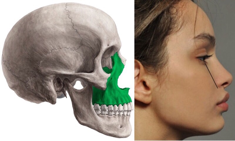 Maxilla – het bot van schoonheid, of alles over onze bovenkaak