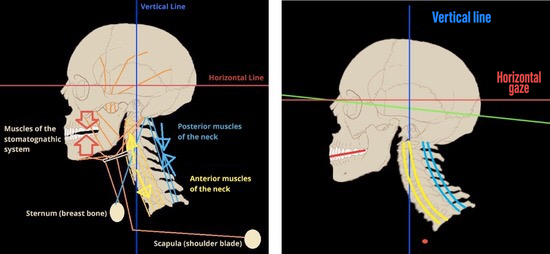 Two lateral skull and neck diagrams with axes, arrows and muscle labels.