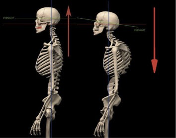 Two lateral skeletons with eye-level lines and red arrows.