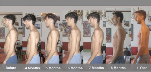 Seven profile photographs of a man with timepoint labels.
