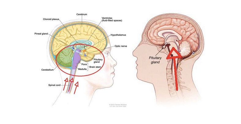 Two sectional brain diagrams with anatomical labels and red arrows.