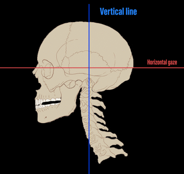 Three animation frames of the skull and neck with vertical, horizontal and tilted lines.